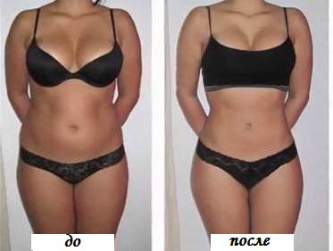 Баночный массаж для похудения живота: отзыв, фото до и после
